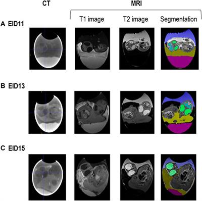 How Egg Storage Duration Prior to Incubation Impairs Egg Quality and Chicken Embryonic Development: Contribution of Imaging Technologies